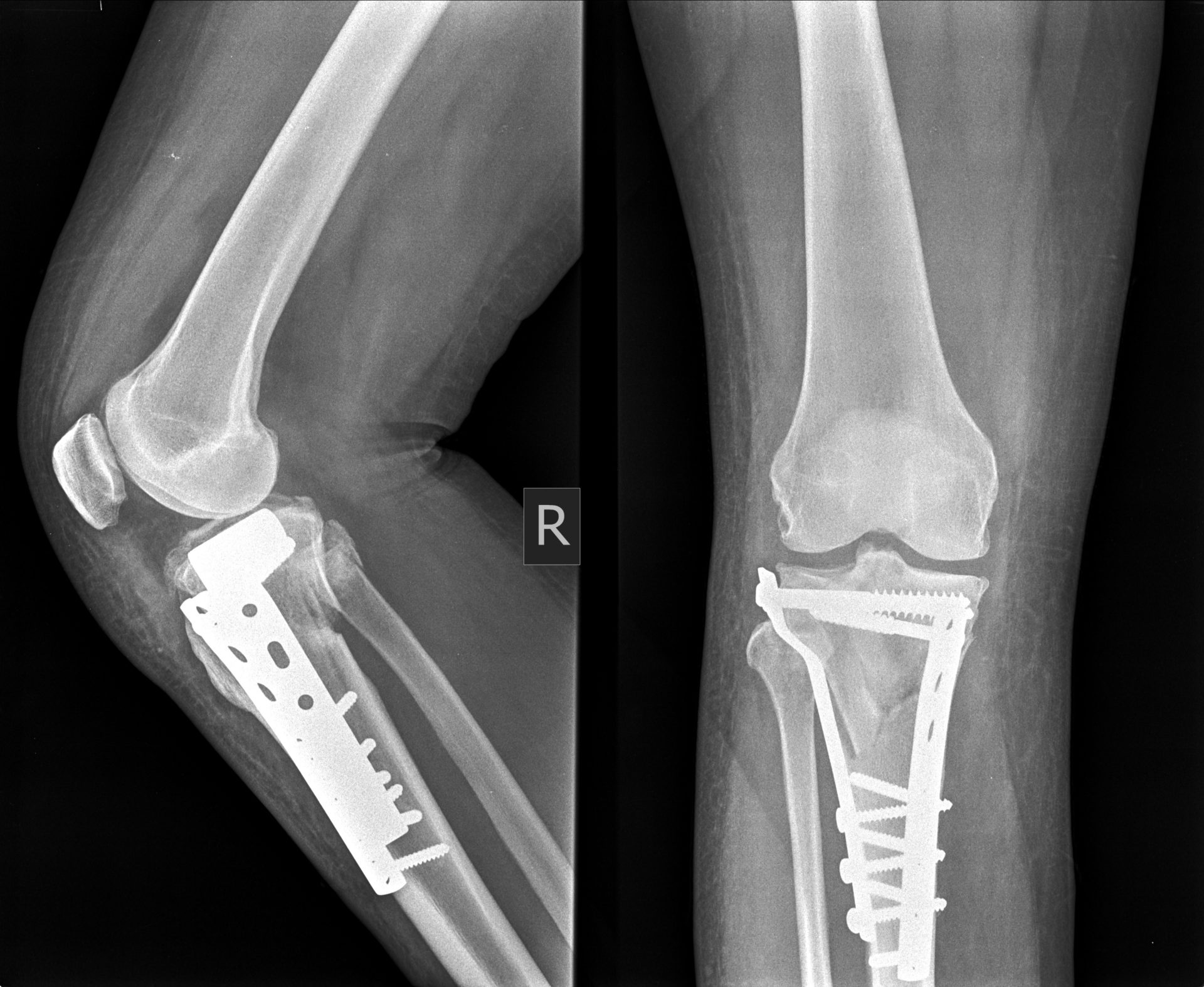 Trauma and fracture specialist in Delhi NCR